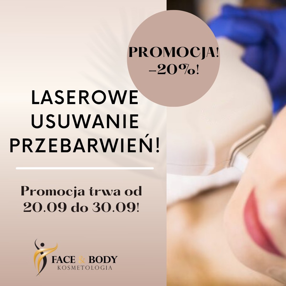 Laserowe usuwanie przebarwień w Salonie kosmetycznym Kosmetologia Face & Body w Andrychowie