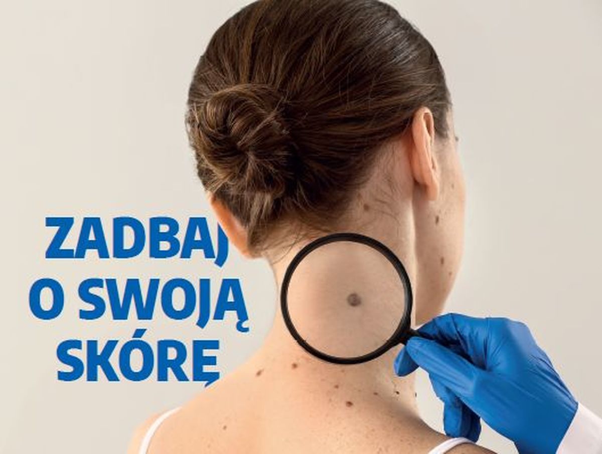 Bezpłatne badanie skóry w Makowie Podhalańskim i Kozach
